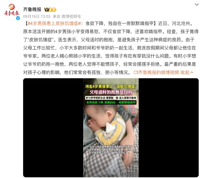 孩子患上“皮肤饥渴症”，父母经常抱抱才能好？ - 千百度社区-千百度社区